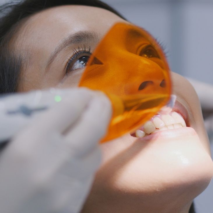 Restorations/Fillings